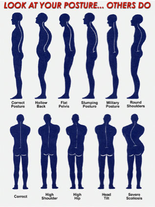 Bad Posture? World Class Posture Correction And Advice.